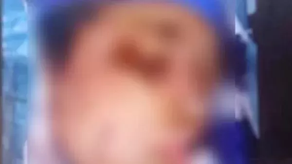 ضحية المعصرة